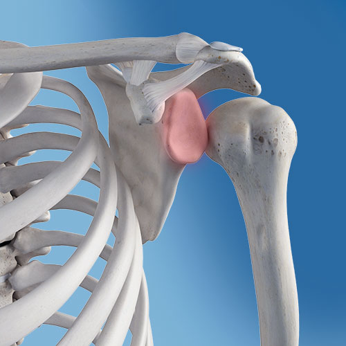 shoulder-dislocation Orthopedics Doctor Help